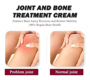 Perfectx Intensive Joint & Bone Therapy Cream (Pack of 2)